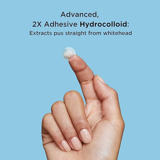 AVARELLE Pimple Patches for Face | Hydrocolloid Acne Patches for Covering Blemishes | FSA HSA Zit Patches with Tea Tree, Calendula, & Cica | HSA Store Eligible Items (10-14 mm, 80 Count)