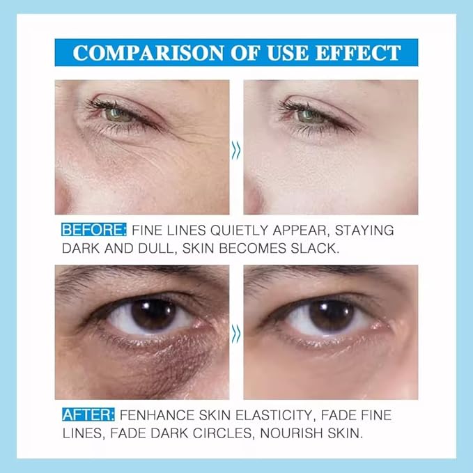 Eye Lift Eye Cream Anti-Wrinkle