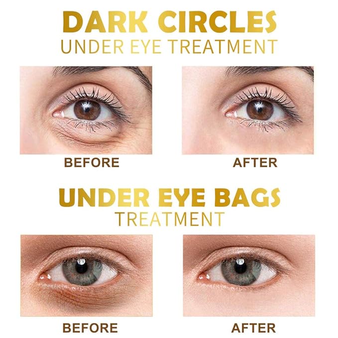 Under Eye Patches, 30 Pairs Gold Eye Mask, Eye Gel Pads With Collagen Treatment for Reducing Dark Circles, Lighten Wrinkles Anti-Aging Moisturizing, Fine Lines Eye Bags Puffiness for Women Men