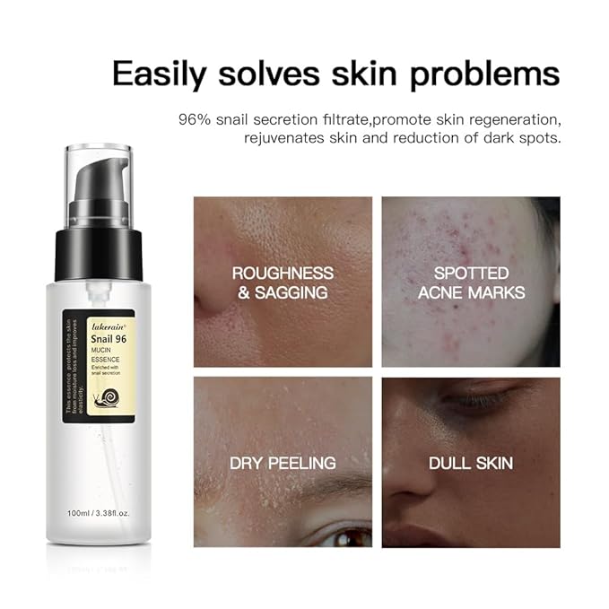 100ML Snail Mucin Serum,Advanced Snail 96 Mucin Power Essence,Snail Mucin Repair Dark Spots,Snail 96,Snail Mucin Essence for Face,Hydration and Moisture,Improve Skin Vitality