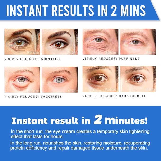 Revitalizing Eye Cream with Hyaluronic Acid, Caffeine, Green Tea - Anti-Wrinkle, Dark Circles,beauty,Firming, Puffiness, Reduce Under Eye Bags, 1 fl oz