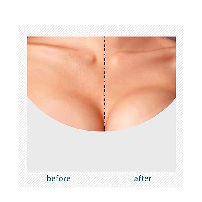 VolksRose Face & Forehead Wrinkle Patches, Reusable Silicone Patches for under Eye, Neck,Chest, Forehead & Nasolabial Areas - Overnight Anti-wrinkle Face Tape Mask, Smile Line Remover Pads