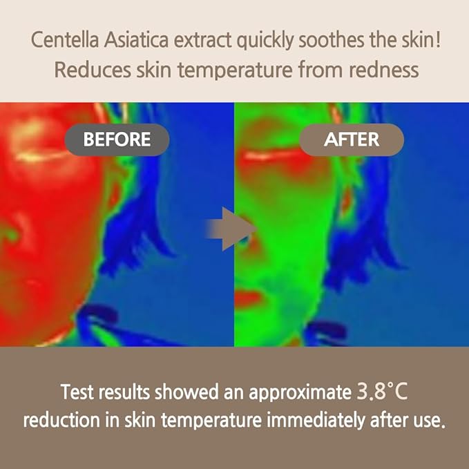 Centella Soothing Serum with Donkey Millk | 100ml 3.38 Fl.Oz | Cooling | Moisturizing | Anti- Inflammatory | Hypoallergenic | Ideal for Sensitive Skin