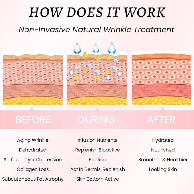 evpct 2Pcs Silicone Chest Smoothing Wrinkle Pads Reusable, Silicone Anti Chest Wrinkle Patches Reusable for Chest Wrinkles Overnight, Décolleté Chest Wrinkle Pillow Pads for Smoother, Size L- T Type