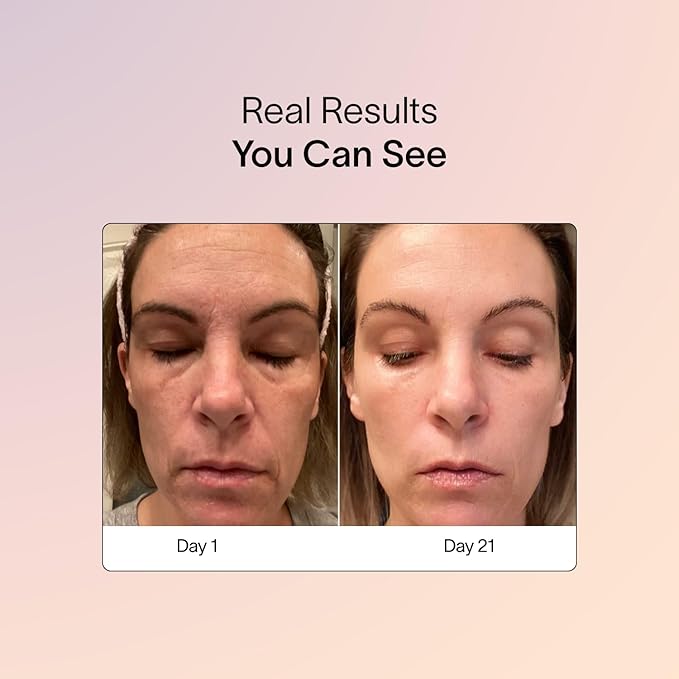 Solawave Wrinkle Retreat Light Therapy Face Mask | Red Light Mask with Infrared Light to restore firm skin | 10 minute treatment