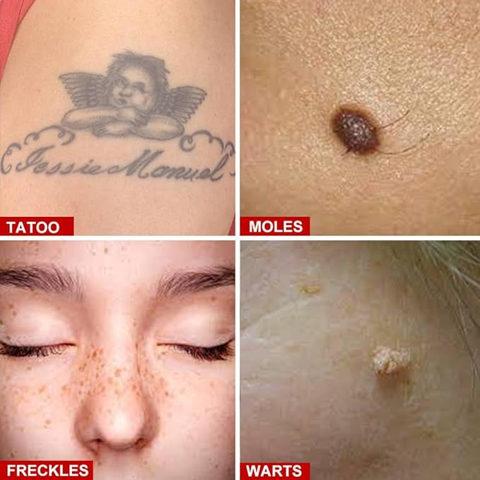 Red Pen Rechargeable for Face Skin Care