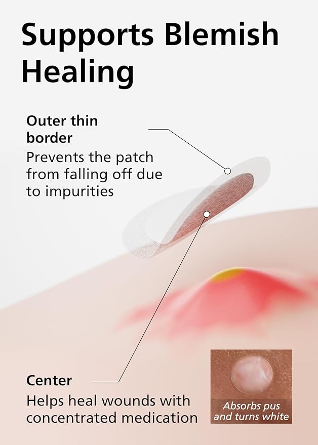 EasyDerm Beauty Patch(84 Counts) - 100% Hydrocolloid Pimple Patch for Zit Spot Care, K-Beauty, Daewoong Pharmaceutical, Korean Acne Patches