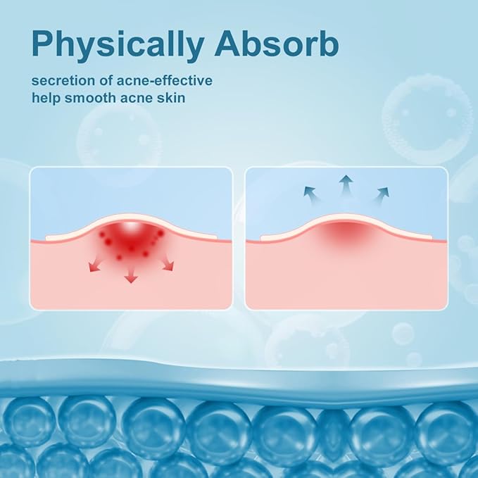 Pimple Patches for Face, Hydrocolloid Acne Patches, Absorb Zits and Blemishes, Invisible Spot Cover, Treatment for Breakouts, Acne Stickers with Salicylic Acid and Tea Tree Oil (72 Count)