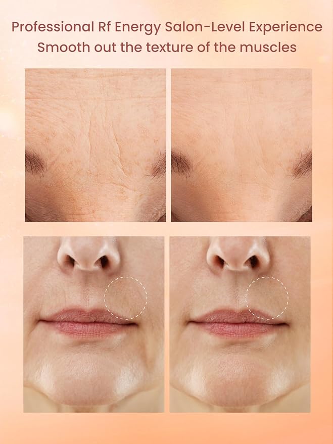Radio Frequency Skin Tightening Device, Professional Wireless Home RF Skin Tightening Face Machine, Effective Face Wrinkle Removal, Lifting, Firming