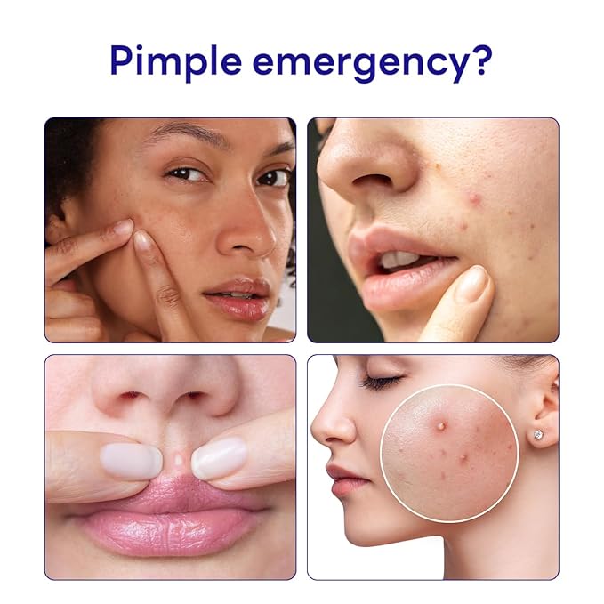 Mediheal Derma Clear Teatree Treatment Spot Patch (132 Counts) - Acne Relief, Oil and Moisture Balance with Teatree & Salicylic Acid