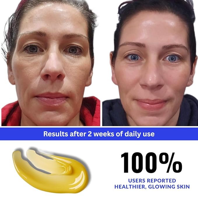 Vitamin C+E Ferulic Acid Serum – Brightening Anti-Aging Face Serum with CoQ10, Niacinamide & Resveratrol – Targets Wrinkles, Hydrates, Evens Tone – Clean, Lightweight, All Skin Types