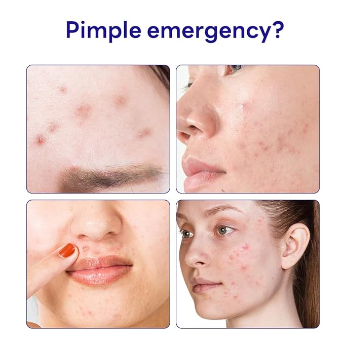 Mediheal Derma Clear Madecassoside Blemish Spot Patch (132 Counts) - Acne Spot Protection, Spot Fast Healing with Madecassoside & Niacinamide