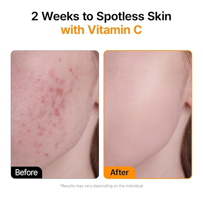 Vita C Ampoule, Dark Spot Correction, Boosting Skin Luminosity, Korean Skin Care, Vegan,0.5 Fl Oz