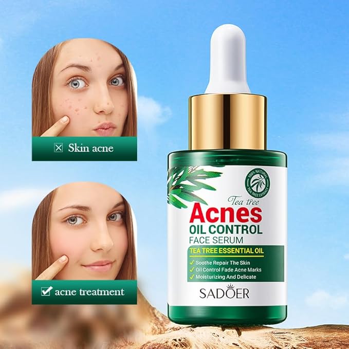 Tea Tree Oil for Face - Acne Serum - Unclog Pores, Soothe Breakouts - Blemish Spot Treatment for Smooth, Glowing Skin - Tea Tree Oil for Skin, 1.1 Fl Oz