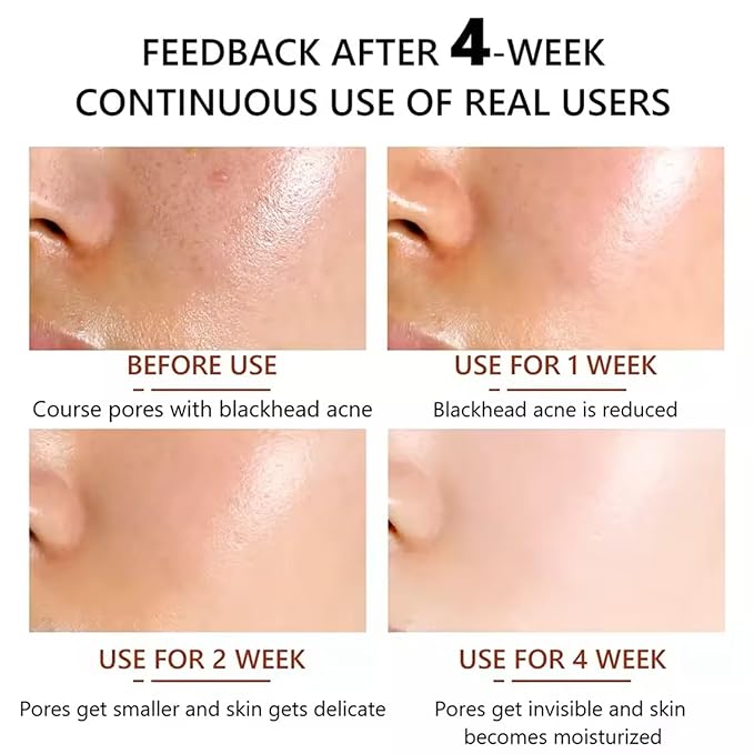 Antioxidants rich 20% Vitamin C Serum for Face with Glycolic Acid and Hyaluronic Acid -RED light therapy serum Boosts Collagen production, Fades Dark Spots, ANTI-AGING, nighttime use (9 serum in 1)