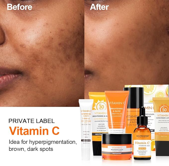 Neutriherbs Vitamin C Toner for Face Alcohol Free Facial Toner with Aloe Vera Witch Hazel Extract Hyaluronic Acid Moisturizing and Smoothing Skin 100ml e/3.38fl. oz.