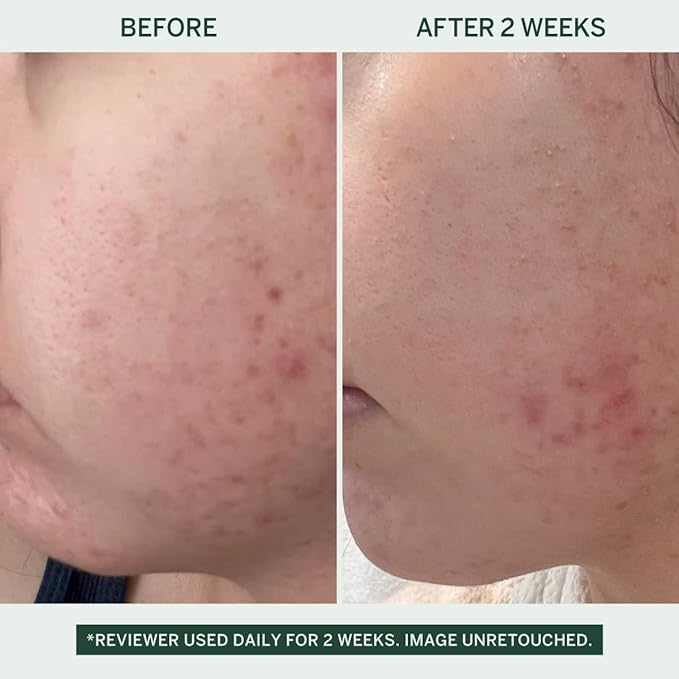 FACETORY 23 Sheet Mask Collection and Urban Calm Vita Serum Bundle - Brightening and Hydrating Skincare Set - 23 Sheet Masks and 1 Niacinamide Serum - for All Skin Types