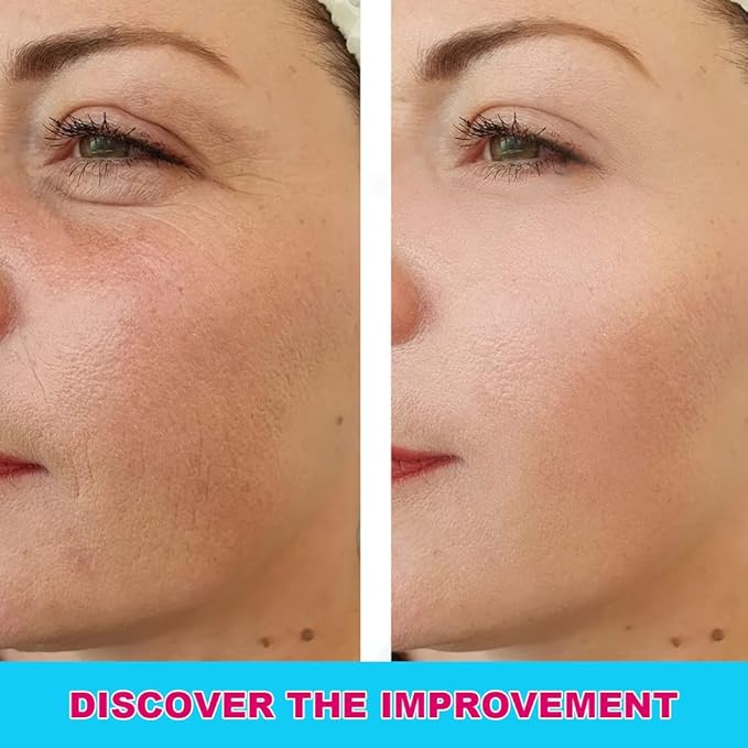 Ceessting Vitamin C Serum for Face - Anti-Aging Facial Serum with Hyaluronic Acid and Vitamin E - Improves Skin Texture, Glow and Elasticity - Reduces Wrinkles, Fine Lines and Dark Spots - 1 oz