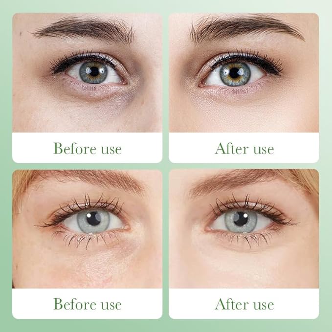 36 Pairs Under Eye Patches & Lip Mask for Puffy Eyes and Dark Circles - Crystal Lip Care Gel Pads Mask Bulk Collagen Skin Care Products, Beauty & Personal Care