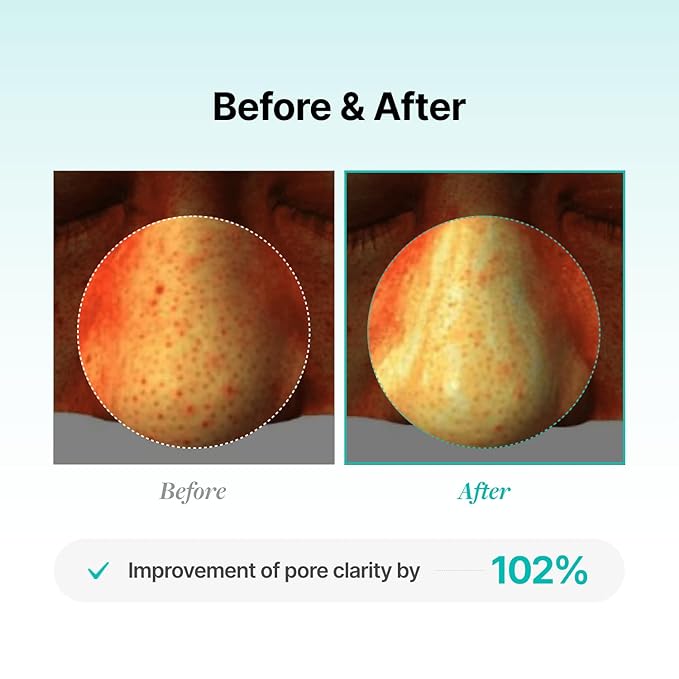 Porethera Real Bifida Powder Serum - Korean Face Serum for Pore Tightening - Pore Minimizer for Face with Probiotic Powder for Skin Balance - Improve Clarity, and Maintain Healthy Skin, 0.51 fl.oz