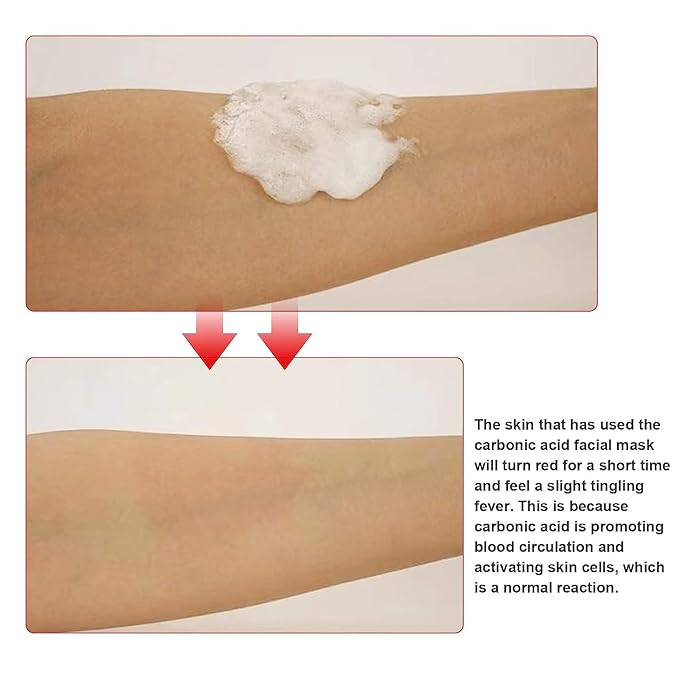 Elitzia CO2 Carboxy Gel Mask Spa Face Masks Skin Facial Care Moisturizing Brighten Natural Beauty 1 box 20 bags ET1719 (Pink)