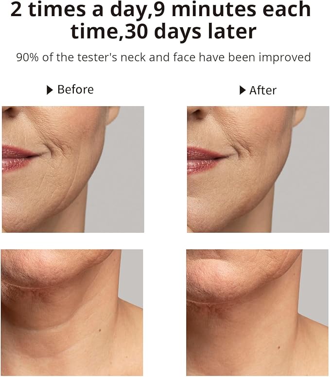 Ms.W Red Light Neck Face Massager, Facial Massager with Hot & Cold Modes for Skin Care, Vibration for Skin Tightening and Rejuvenation（Black）