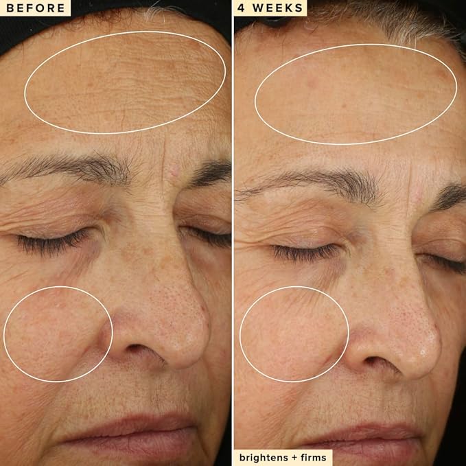 Farmacy 10% Vitamin C Face Serum - Waterless Vitamin C Skin Care Serum to Brighten, Firm + Smooth Skin Texture - Enriched with Upcycled Tangerine Peel to Boost Skin's Moisture + Radiance (30ml)