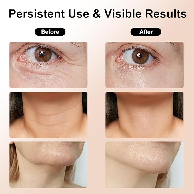 Facial and Neck Massage Kit, Neck Face Tightening Device, 3 Massage Modes for Skin Care at Home (Black)