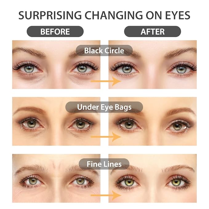 NEWGO Under Eye Mask Patches 20 Pairs Eye Gel Pads, 24K Gold Under Eye Pads Eye Mask Moisturizer Natural Collagen Eye Gels Reduce Wrinkles, Puffy Eyes, Dark Circles, Eye Bags