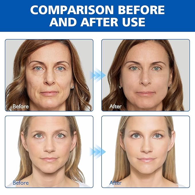 West Month Firming Facial Serum, Skincare Stock Solution, Stock Solution Facial Serum, Reduce Fine Lines Skin-Smooth Looking Skin, Deep Wrinkle Repair Serum, Suitable for All Skin Types(2PC)