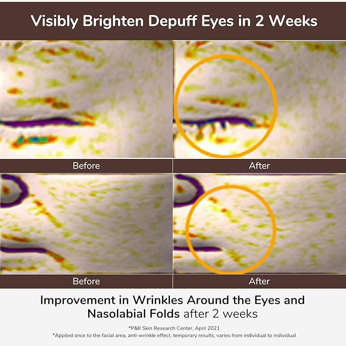 80% Collagen With Gold Peptides Eye Cream - Snail Secretion Filtrate + Matrixyl 3000 + Haloxyl For Wrinkles, Dark Circles, Moisturizer - Korean Skin Care, 0.7 fl.oz