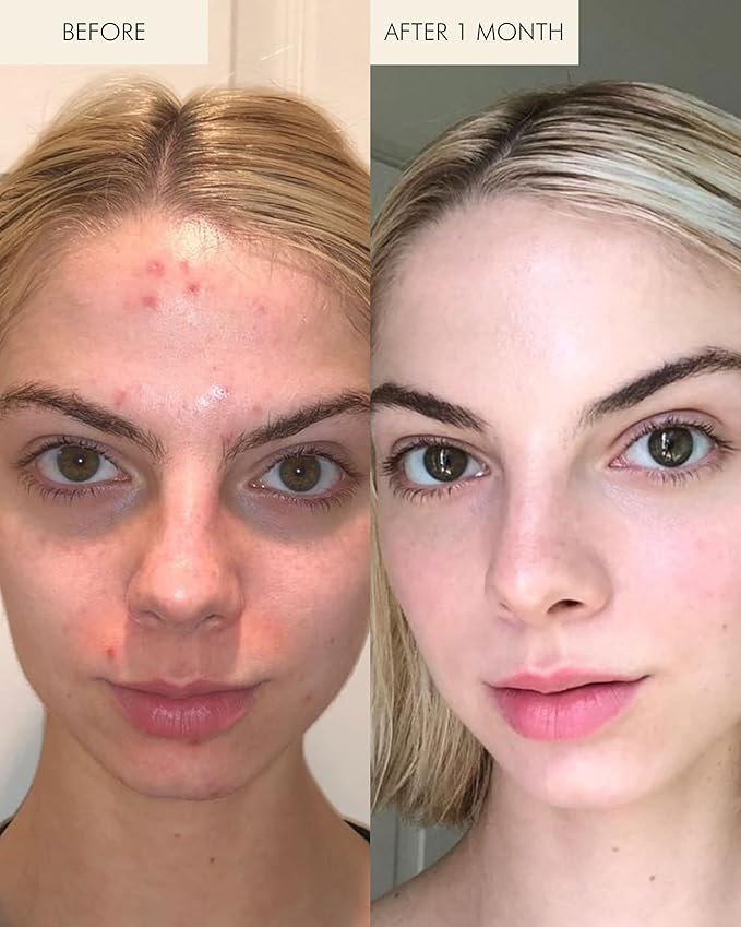 MARA - Natural Evening Primrose + Green Tea Algae Retinol Face Oil | Plant-Based Skin Care | Moisturizes + Soothes Skin To Minimizes Look of Pores + Fine Lines (Full Size, 1 fl oz | 30 ml)