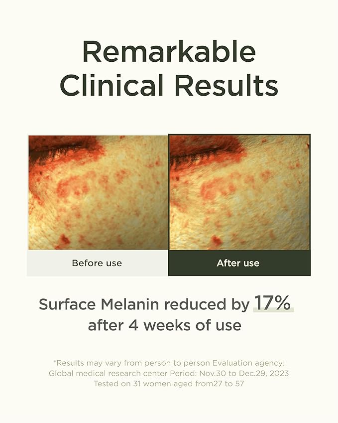 Calendula Vita Serum (1.35fl oz) - Hydrating Serum for an Even Skin Tone Infused with Calendula Extract, Vitamin C Derivatives, and Soothing Ingredients