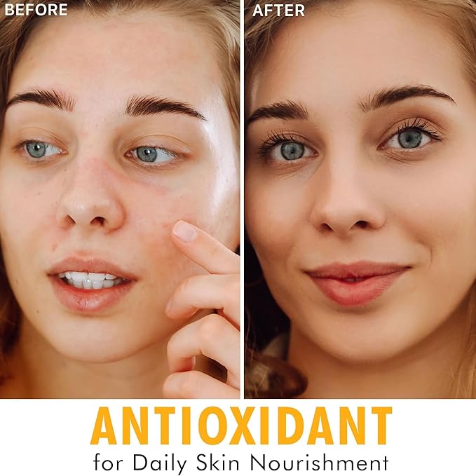 Vitamin C Face Serum - USA Made with Natural & Organic Ingredients, Skin Brightening Vitamin C Serum for Face for Women, Discoloration Correcting & Anti Aging Facial Formula with Antioxidants