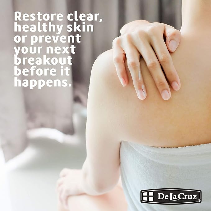 De La Cruz 5% Sulfur Ointment - Cystic Acne Treatment for Face and Body - Daily 10 Min Spot Treatment Mask - Safe and Effective Game Changing Hormonal Acne Treatment that Clears Up Pimples 2.6oz Tube