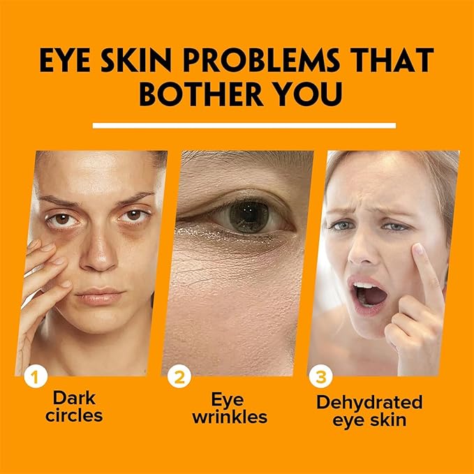 Lumibalm for Under Eye Bags, Turmeric Retinol Eye Cream Stick, Retinol Eye Cream Stick for Dark Circles, Wrinkles, Anti-Aging and Puffiness