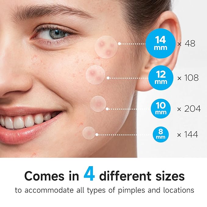 Pimple Patches for Face (504 Counts), Bulk Acne Patch, Zit Stickers 4 Sizes, Hydrocolloid Spot Stickers, Clear Acne Dots for Covering Zits, Blemishes and Breakouts