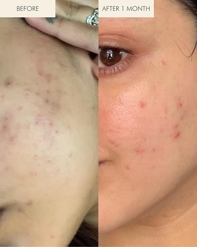 MARA - Natural Chlorella + Reishi Sea Vitamin C Serum | Plant-Based Skin Care | Skin Firming With Moringa + Squalane (0.5 oz | 15 ml)