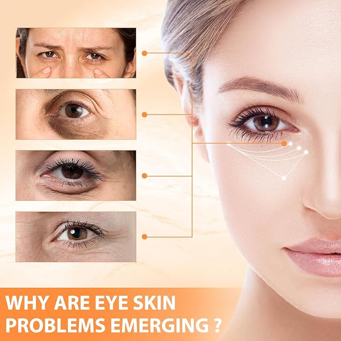 2PCS Revive Glow Vitamin C Eye Balm, Reducing Dark Circle,Hydrating Eye Cream,Improve Dark Circles,Reduces Puffiness (2pcs)