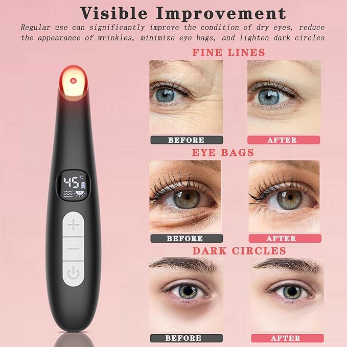 Eye Lift Wand, 3 in 1 Vibrating 98°F to 113°F LCD Eye Massager for Dry Eyes, Dark Circles and Puffiness, Face & Neck Lifting Tool for Fine Lines and Wrinkles, Black
