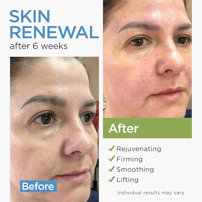 Collagen Face Cream with Stem Cells Retinol Hyaluronic Acid Niacinamide - Anti-Aging Collagen Face Moisturizer with Airless Pump - Day & Night Moisturizer for Wrinkles - Made in USA