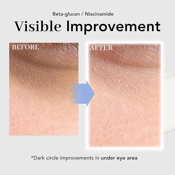 NOWATER Collagen Eye Cream for Wrinkles, Puffiness, Dark Circles - Hydrolyzed Collagen & Beta-glucan for Improved Under-eye Area, Korean Skincare (0.88 fl.oz)