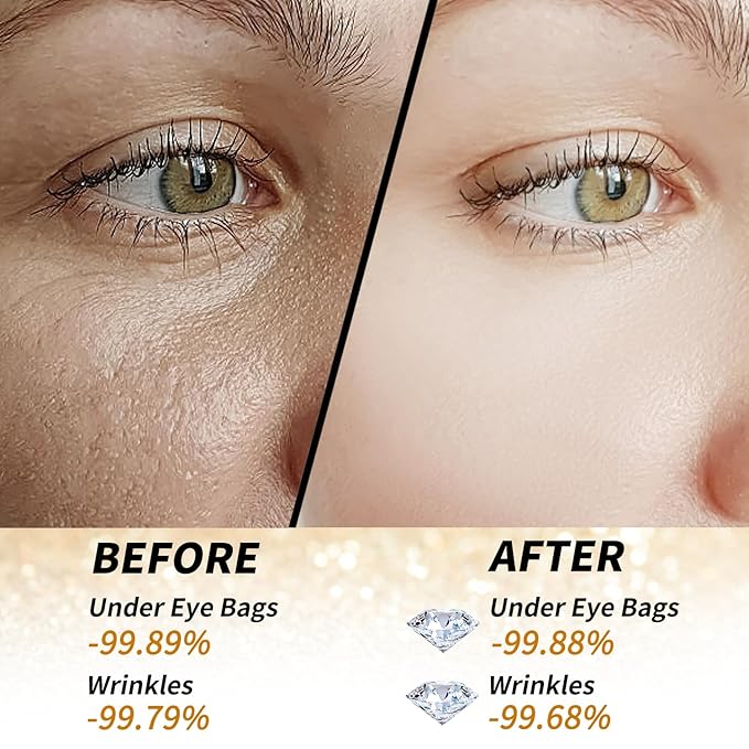 Golden Glow Under Eye Patches for Puffy Eyes - 60Pcs Eye Gels Rejuvenating Treatment for Dark Circles, Puffiness, Refreshing,Revitalizing Looks Less Tired