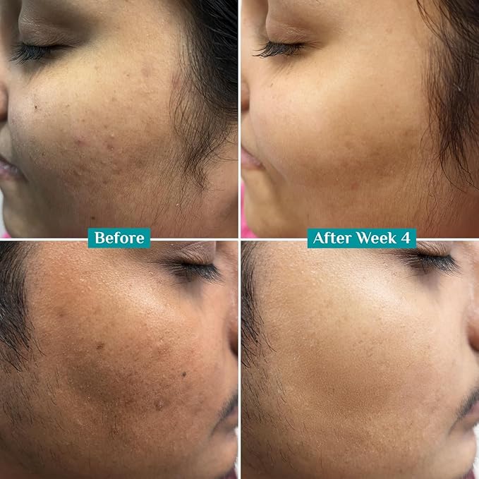 10% Vitamin C Face Serum | Anti Aging Facial Serum with 5% Niacinamide & Kakadu Plum | Reduces Fine Lines, Smooths Skin Texture & Improves Radiance | 1.01 Fl Oz (30ml)