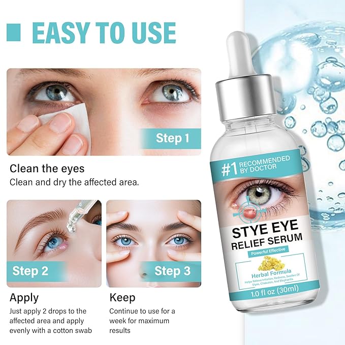 Stye Eye Treatment, Effective Stye Eye Relief Drop, for S_tyes Blepharitis and Chalazion Treatment, Regain Healthier Ey_e Skin