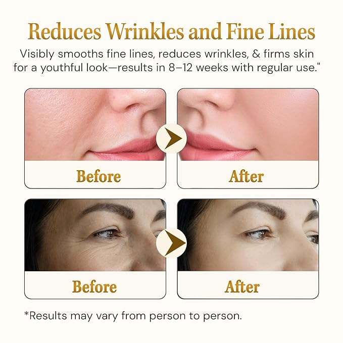 Anti Aging Serum Matrixyl 3000 with Hyaluronic Acid, Peptide Collagen, Argireline Best for Deep Wrinkle Repair, Hydrating Face Serum for All Skin Types, 1.01 Fl Oz