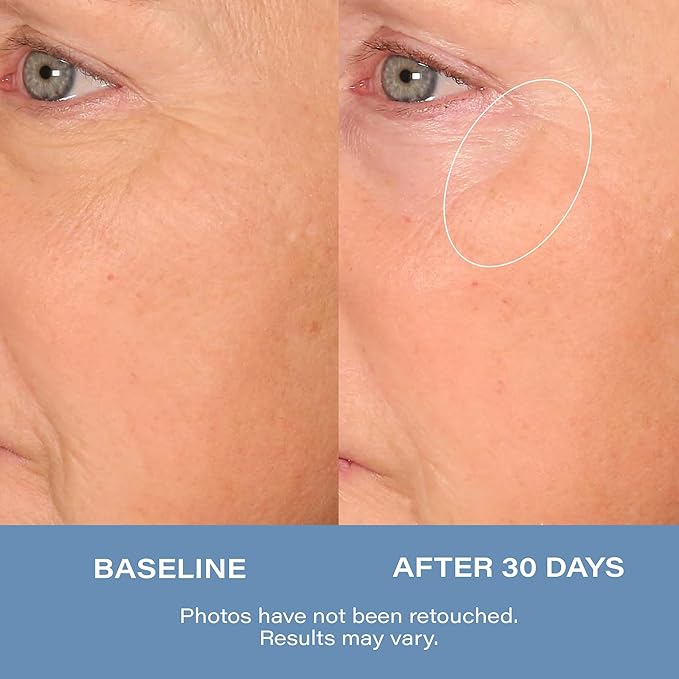 SKINN Advanced Night Cream for Face, 1.7 Fl Oz - Deep Wrinkle Cream for Women & Men for Fine Lines, Uneven Skin Tone & Sagging Skin - Facial Moisturizer Skin Care for Vibrant & Healthy-Looking Skin