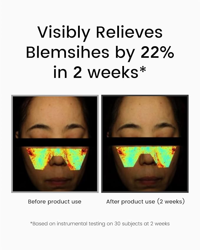 Korean Retinol Serum for Face (1fl oz) – Youth Rejuvenating Face Ampoule for Improving Fine Lines & Reducing Pigmentation, Skin Care for Day & Night Use. Vitamin C, Niacinamide, Peptide