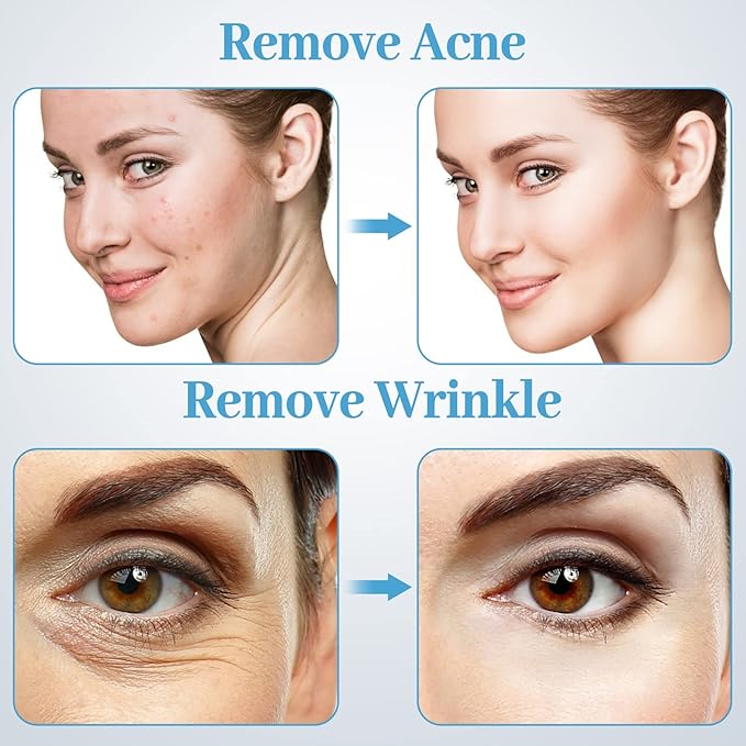 Microderm Machine with Spray Gun, mcwdoit Professional Facial Skin Care Beauty Device Home Salon (Suction Power: 0-68cmhg)