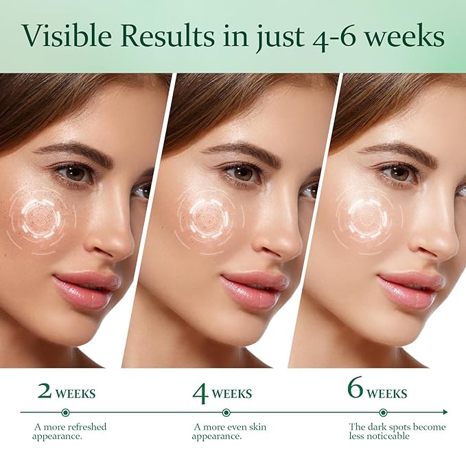 Dark Spot Remover for Face with Roller: Dark Spot Corrector for Face Fading Sun Spot Age Spot Melasma
